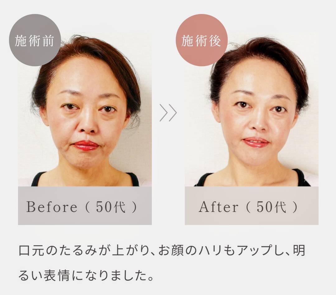 施術前後の比較